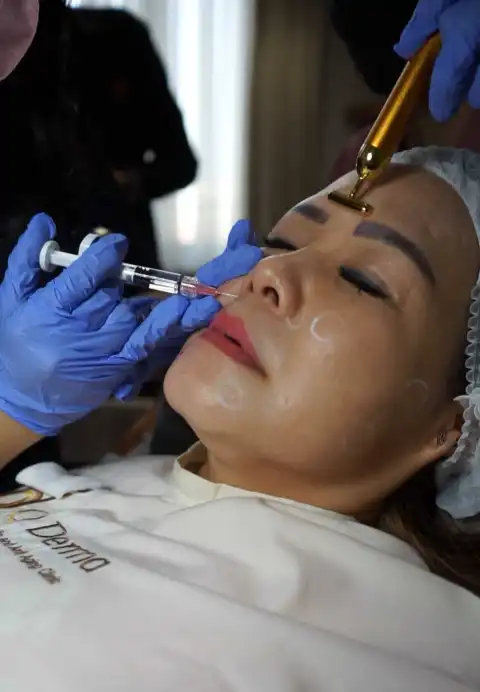 Dokumentasi-Q-Derma-Clinic-Treatmetn-Profhilo